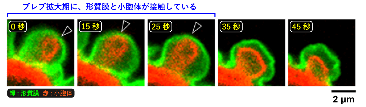 <dfn class="fig">図10</dfn>：<span class="qrinews-figure-title">ブレブにおける形質膜と小胞体の挙動</span>　形質膜を緑で、小胞体を赤で標識している。拡大期のブレブでは、形質膜と小胞体が接触し、形質膜-小胞体コンタクトサイトを形成している（黒矢頭）。<a href="#app1" class="link-to-lower-part"><cite class="article"><span class="i">Aoki et al</span>. (2021)</cite></a> の図を改変。